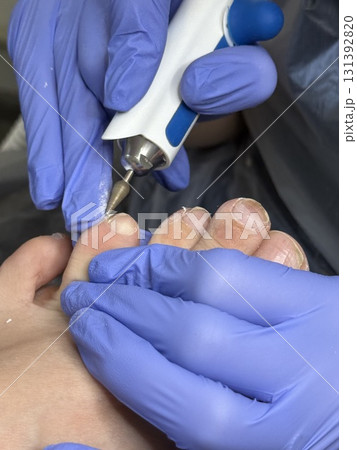 A professional podologist cleans the skin under the big toe nail of a female client with a special tool. Foot care 131392820