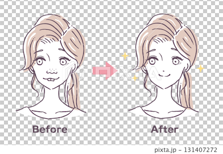 整容手術前後向量插圖素材 131407272