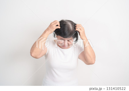 Elderly woman having itchy Scalp and Head hair, Dandruff, Dry Scalp, Skin Allergy Seborrheic dermatitis. Dermatology, Leprosy day, Systemic lupus erythematosus, SLE, Psoriasis and Atopic Eczema rash 131410522