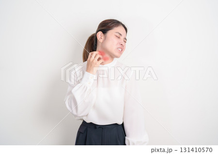 Business woman itching Neck and body scratching for Skin Allergy from insect bite and food dermatitis. Dermatology, Leprosy day, Systemic lupus erythematosus, Psoriasis, Urticaria and rash Eczema 131410570