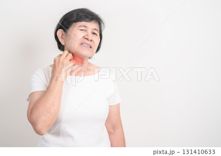 Elderly woman itching Neck and body scratching for Skin Allergy from insect bite and food dermatitis. Dermatology, Leprosy day, Systemic lupus erythematosus, Psoriasis, Urticaria and rash Eczema 131410633