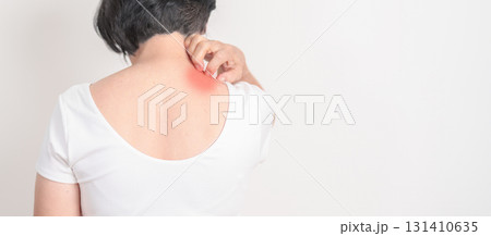Elderly woman itching Neck and body scratching for Skin Allergy from insect bite and food dermatitis. Dermatology, Leprosy day, Systemic lupus erythematosus, Psoriasis, Urticaria and rash Eczema 131410635