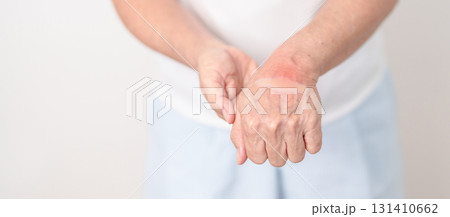 Elderly Woman having wrist pain with Medicated pain relief patch plaster for Carpal Tunnel Syndrome, Wrist Tendinitis, muscle ache, De Quervain s tenosynovitis, Hand Osteoarthritis and Senior health 131410662