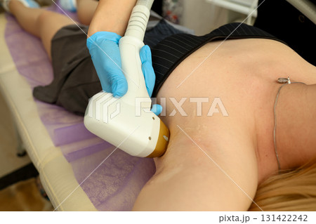 Laser hair removal procedure on underarm in beauty clinic Laser hair removal procedure on underarm in beauty clinic 131422242