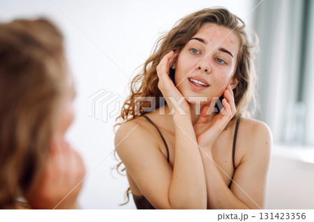 Skin problem. Natural beauty. Medical care and treatment concept. 131423356