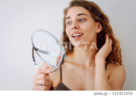curly woman with rashes on her face is worried about the health of her skin. Dermatology concept. curly woman with rashes on her face is worried about the health of her skin. Dermatology concept. 131423358