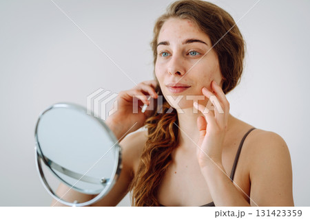 curly woman with rashes on her face is worried about the health of her skin. Dermatology concept. curly woman with rashes on her face is worried about the health of her skin. Dermatology concept. 131423359