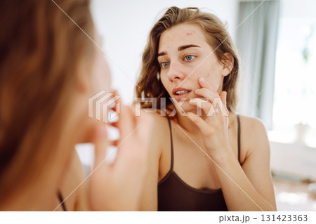 Skin problem. Natural beauty. Medical care and treatment concept. Skin problem. Natural beauty. Medical care and treatment concept. 131423363