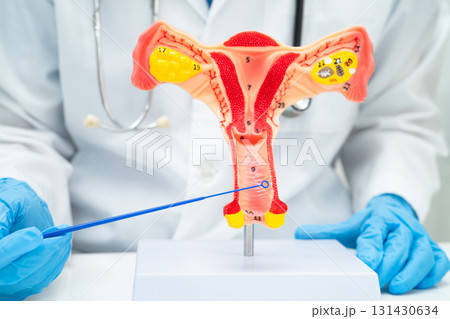 Doctor holding human uterus model for vaginal and cervix pap smear check up in the obstetrics and gynecology. 131430634