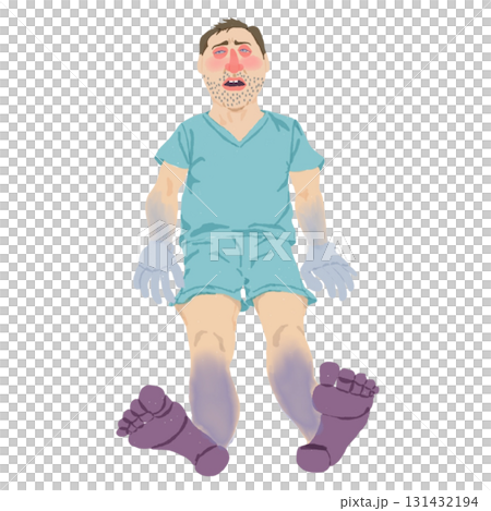 感染性休克患者的全身性圖示（發紺和潮紅） 131432194