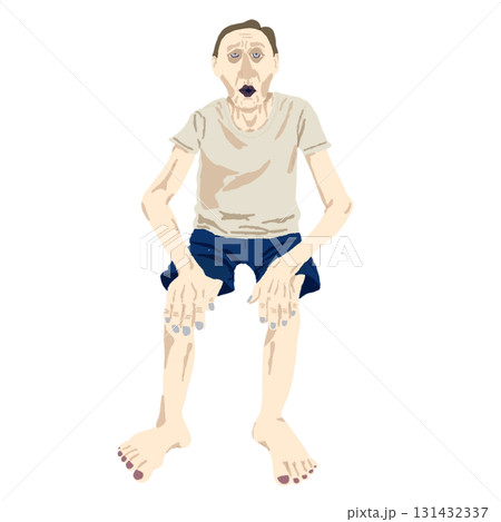 COPD患者の典型的身体所見イラスト(口すぼめ呼吸・三脚呼吸) COPD患者の典型的身体所見イラスト(口すぼめ呼吸・三脚呼吸) 131432337