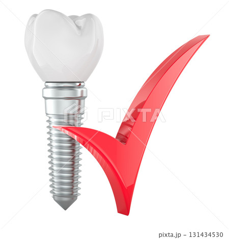 Dental implant with red check mark. 3D rendering 131434530