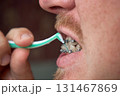 Adult man brushes his teeth with braces by interdental brush 131467869