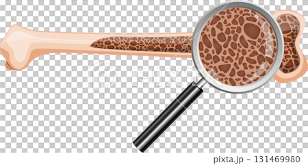 Bone structure shown through a magnifying glass reveals trabecular bone inside the organ. Bone structure shown through a magnifying glass reveals trabecular bone inside the organ. 131469980