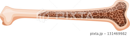 Illustration of a bone showing the outer compact bone and inner spongy bone structure. Illustration of a bone showing the outer compact bone and inner spongy bone structure. 131469982