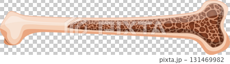 Illustration of a bone showing the outer compact bone and inner spongy bone structure. Illustration of a bone showing the outer compact bone and inner spongy bone structure. 131469982