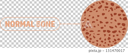 Illustration of healthy bone matter and cell structure. This is a diagram to explain. 131470017