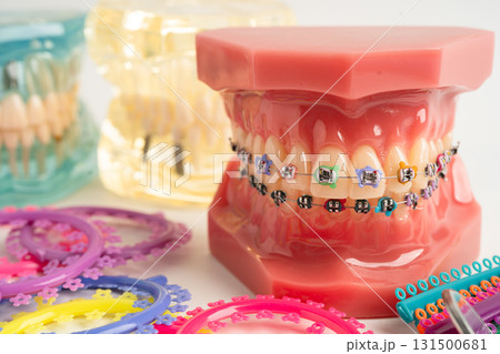 Orthodontic ligatures rings and ties, elastic rubber bands on orthodontic braces, model for dentist studying about dentistry. Orthodontic ligatures rings and ties, elastic rubber bands on orthodontic braces, model for dentist studying about dentistry. 131500681
