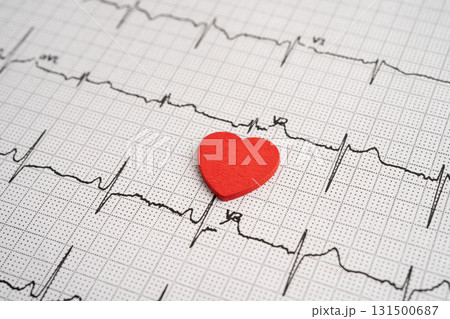 Electrocardiogram ECG, heart wave, heart attack, cardiogram report. 131500687
