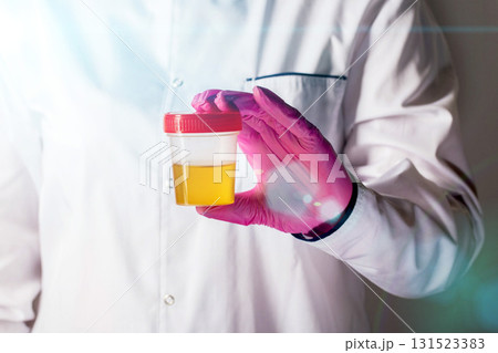 A doctor urologist holds a urine test in his hand in a pink glove, close-up. Cognition of diseases and infections in urology. Copy space for text 131523383