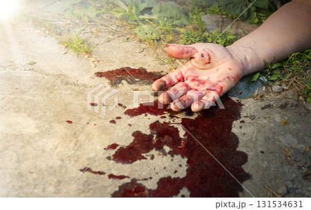 A man's hand in blood lies on the ground 131534631