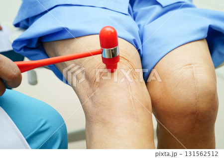 Asian doctor knock on knee reflex nerve for check and treatment senior patient in hospital. Asian doctor knock on knee reflex nerve for check and treatment senior patient in hospital. 131562512