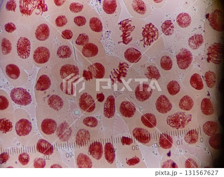玉ねぎの染色体の観察 131567627