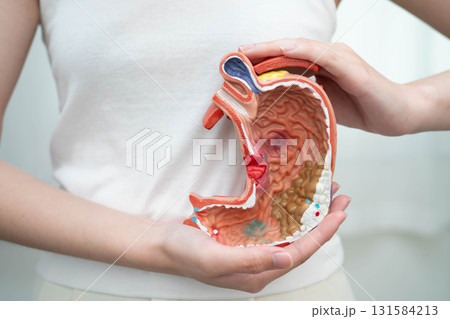 Stomach disease, Asian woman holding anatomy model for study diagnosis and treatment in hospital. 131584213