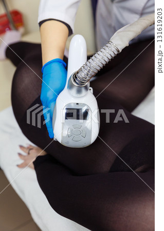 LPG massage procedure for removing subcutaneous fat from a young woman. 131619203