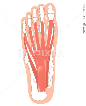 足底筋膜 足底腱膜 足底筋膜炎 足の筋肉 足底筋膜 足底腱膜 足底筋膜炎 足の筋肉 131629462
