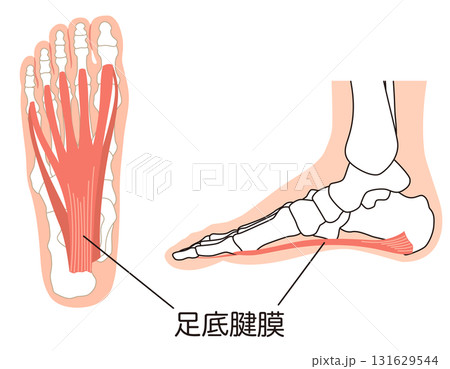 足底筋膜　足底腱膜　足底筋膜炎　足の筋肉 131629544
