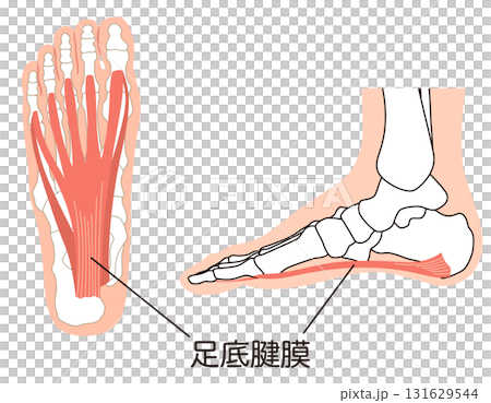 足底筋膜　足底腱膜　足底筋膜炎　足の筋肉 131629544