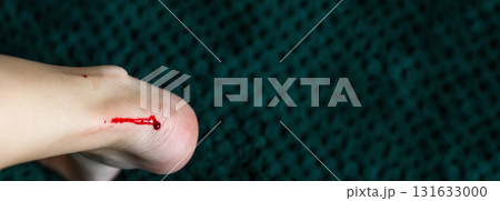 a woman's leg or foot showing a small wound and blood near the heel, resulting from a shaving cut. minor wound copy space first aid. razor safety banner image a woman's leg or foot showing a small wound and blood near the heel, resulting from a shaving cut. minor wound copy space first aid. razor safety banner image 131633000