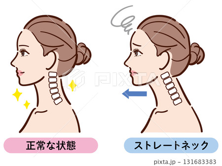 正しい姿勢とストレートネックの比較イラスト（女性横顔） 131683383