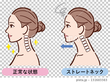 正しい姿勢とストレートネックの比較イラスト（女性横顔） 131683383
