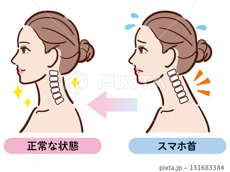 スマホ首から正常な状態への変化イラスト（女性横顔） 131683384