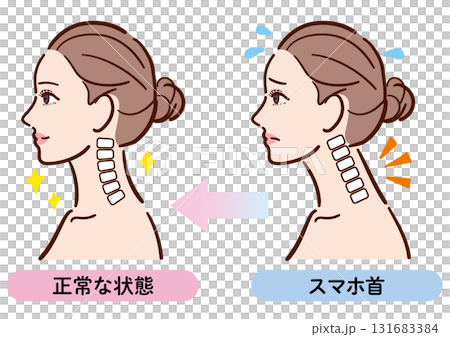 スマホ首から正常な状態への変化イラスト（女性横顔） 131683384