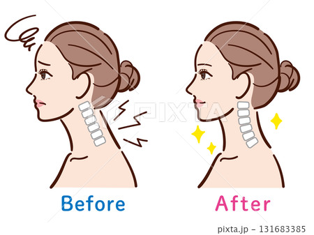 ストレートネックから正常な状態への変化イラスト(女性横顔) ストレートネックから正常な状態への変化イラスト(女性横顔) 131683385