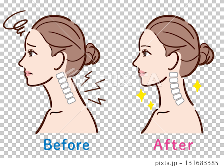 ストレートネックから正常な状態への変化イラスト(女性横顔) ストレートネックから正常な状態への変化イラスト(女性横顔) 131683385