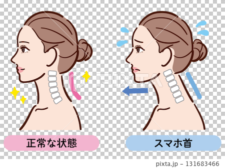 正確姿勢與智慧型手機頸部的比較圖（女性側面） 131683466