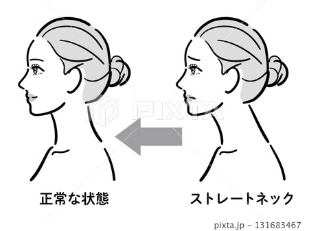 ストレートネックから正常な状態への変化イラスト（女性横顔） 131683467
