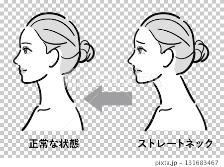 ストレートネックから正常な状態への変化イラスト（女性横顔） 131683467