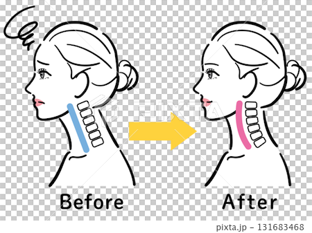 Illustration of the change from a straight neck to a normal state (female profile) 131683468