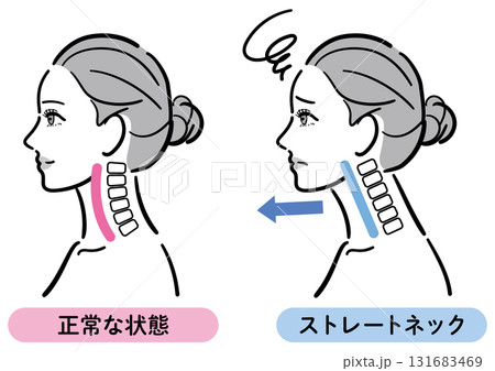 正しい姿勢とストレートネックの比較イラスト（女性横顔） 131683469