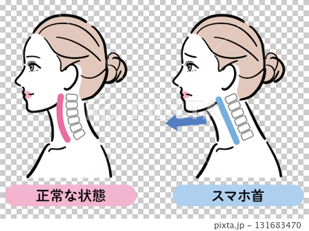 正しい姿勢とスマホ首の比較イラスト（女性横顔） 131683470