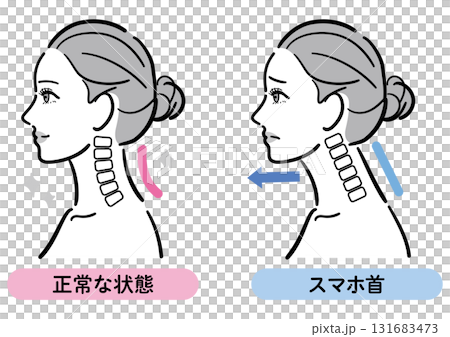 正常な状態とスマホ首の比較イラスト（女性横顔） 131683473