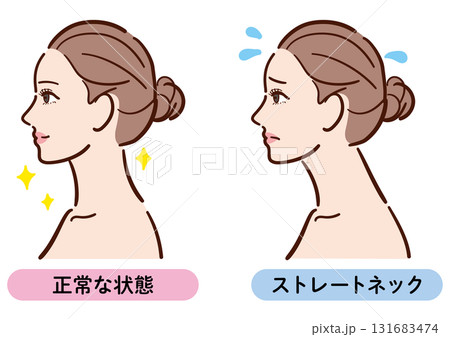 正しい姿勢とストレートネックの比較イラスト（女性横顔） 131683474