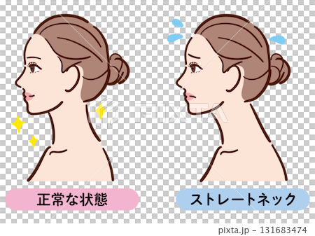 正しい姿勢とストレートネックの比較イラスト（女性横顔） 131683474