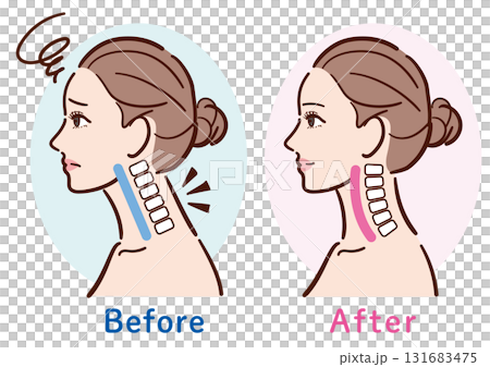 Illustration of the change from a straight neck to a normal state (female profile) 131683475
