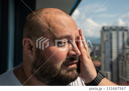 Fat man suffers dying from heat. Guy on balcony under hot summer sun sweats from high temperatures 131687567